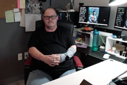 ‘would-not-wish-it-on-my-worst-enemy,’-says-winnipegger-sidelined-with-rare-pain-syndrome