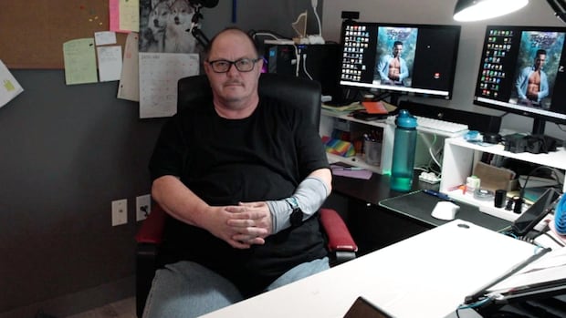 ‘would-not-wish-it-on-my-worst-enemy,’-says-winnipegger-sidelined-with-rare-pain-syndrome
