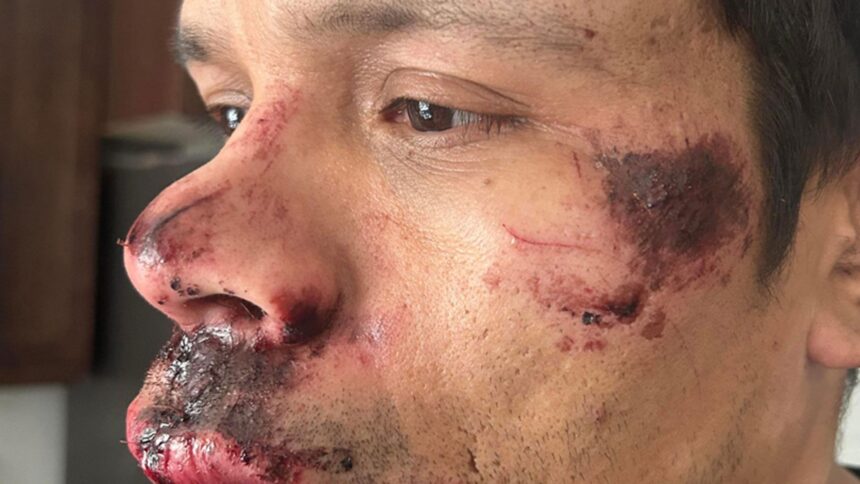pasqua-first-nation-man-with-disability-assaulted-and-electric-bike-stolen-in-regina