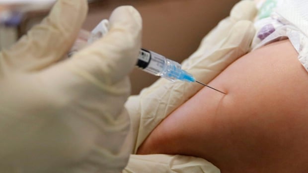 measles-case-confirmed-in-kingston-area