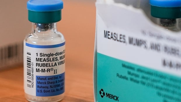 more-potential-measles-exposures-in-kingston,-belleville