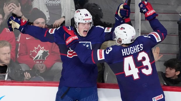 ehlers-danlos-syndrome-forced-a-winnipeg-jets-draft-pick-to-retire-at-21.-what-is-it?