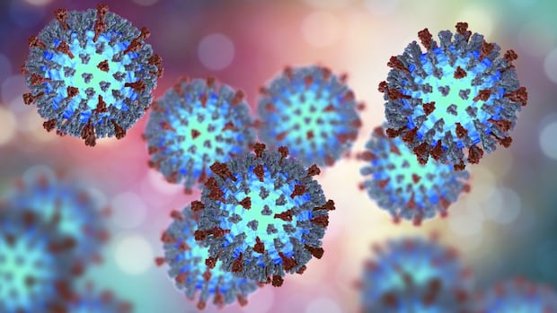2-new-measles-cases-confirmed-in-southern-manitoba