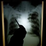 mobile-x-ray-program-being-brought-to-residents-of-pei.-long-term-care-homes
