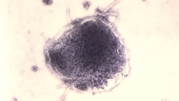 ontario-reports-95-new-measles-cases,-sending-total-above-1,000-since-outbreak-began