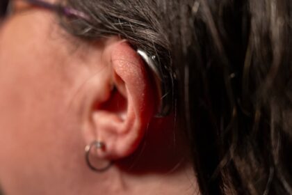 like-dyslexia,-but-for-the-ears,-says-this-woman-about-life-with-auditory-processing-disorder