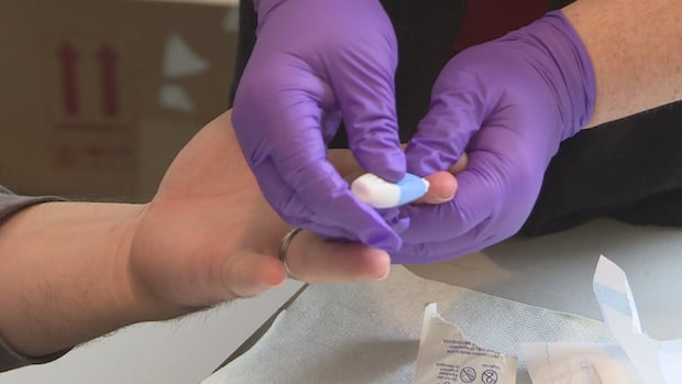 pei.-a-‘front-runner’-in-canada-when-it-comes-to-eliminating-hepatitis-c,-say-health-officials