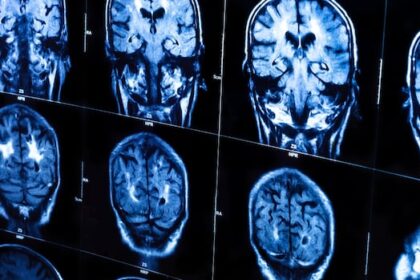 new-brunswick-has-no-mystery-neurological-disease,-scientific-study-concludes