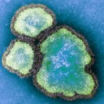 ontario-reports-nearly-200-new-measles-cases-as-virus-spreads-across-canada
