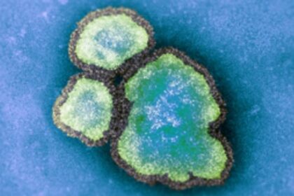 ontario-reports-nearly-200-new-measles-cases-as-virus-spreads-across-canada