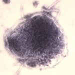 ottawa-has-1st-confirmed-measles-cases-since-2019
