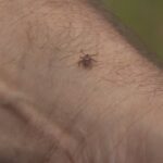 take-tick-precautions,-but-lyme-disease-rates-remain-quite-low-on-prince-edward-island