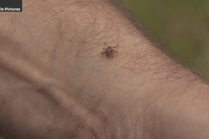 take-tick-precautions,-but-lyme-disease-rates-remain-quite-low-on-prince-edward-island