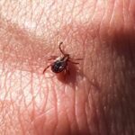 preventative-measures-can-reduce-tick-risk-on-pei.,-experts-say