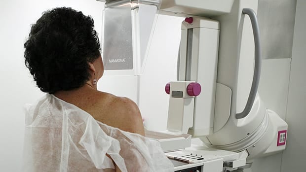 major-overhaul-ordered-for-panel-that-sets-canada’s-cancer-screening-guidelines