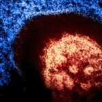 measles-cases-confirmed-in-kamloops-and-chilliwack;-exposures-reported-on-bc.-ferry