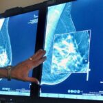 sask.-women-45+-can-now-self-refer-for-breast-screening-mammograms,-but-awareness,-capacity-issues-continue