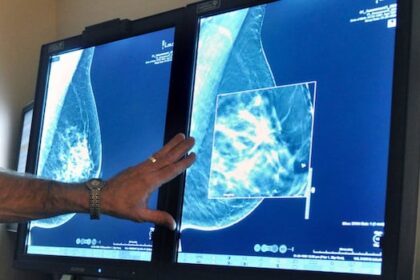 sask.-women-45+-can-now-self-refer-for-breast-screening-mammograms,-but-awareness,-capacity-issues-continue
