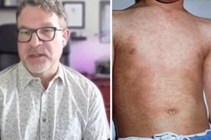 measles-spread-‘like-wildfire’-among-unvaccinated-children-in-northeast-bc.,-health-officer-says