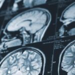 patients-ask-holt-to-intervene-in-nb.’s-mystery-brain-illness-investigation