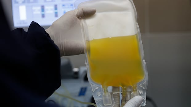 equipment-failure-at-winnipeg-clinic-caused-blood-plasma-donor’s-kidney-injury,-lawsuit-alleges