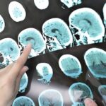 health-pei.-has-been-overpaying-ontario-firm-for-radiology-services-for-years,-watchdog-says