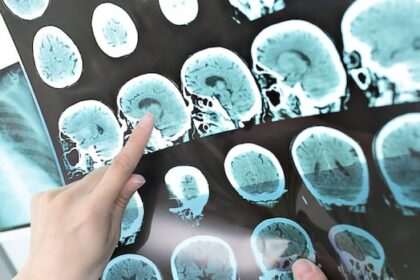 health-pei.-has-been-overpaying-ontario-firm-for-radiology-services-for-years,-watchdog-says