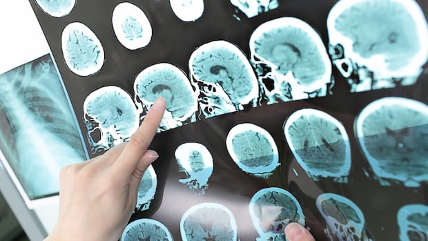 health-pei.-has-been-overpaying-ontario-firm-for-radiology-services-for-years,-watchdog-says