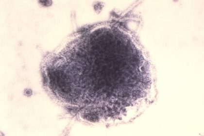 7-new-confirmed-measles-cases-reported-in-manitoba-last-week