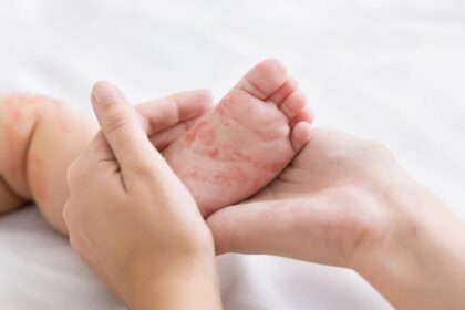 manitoba-health-warns-of-measles-exposure-at-emergency-room,-winkler-medical-centre