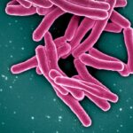 tuberculosis-spike-in-nunavik-has-complex-causes,-needs-complex-solutions:-experts