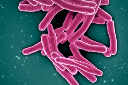 tuberculosis-spike-in-nunavik-has-complex-causes,-needs-complex-solutions:-experts