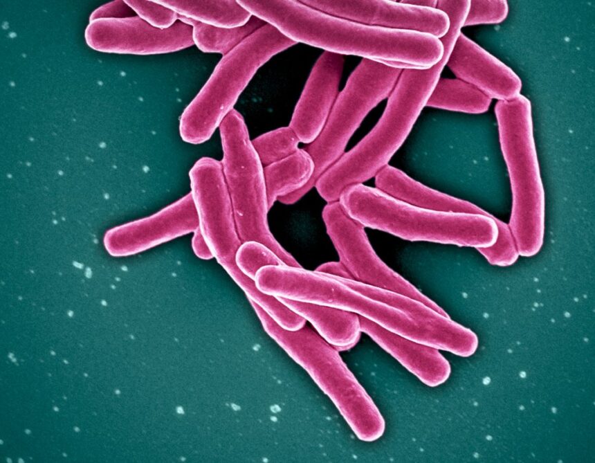 tuberculosis-spike-in-nunavik-has-complex-causes,-needs-complex-solutions:-experts