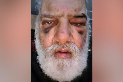 ‘brutal-and-senseless-assault’-leaves-senior-with-multiple-injuries-on-vancouver-island