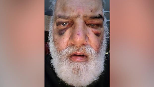 ‘brutal-and-senseless-assault’-leaves-senior-with-multiple-injuries-on-vancouver-island