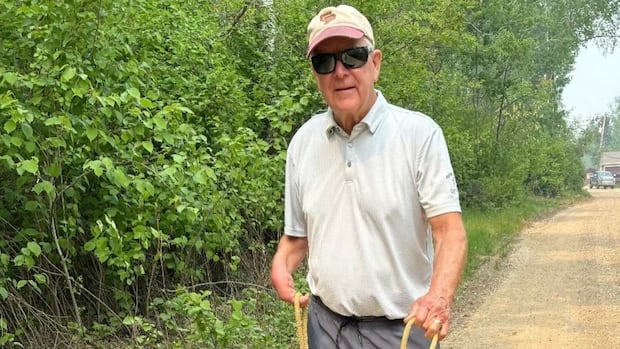 rare-case-of-rocky-mountain-spotted-fever-confirmed-in-sask.