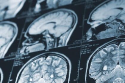 nb.-delays-report-on-mystery-brain-illness,-sends-all-data-for-federal-review