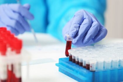 for-over-30-years,-this-small-bc.-city-has-been-testing-children’s-blood-for-lead