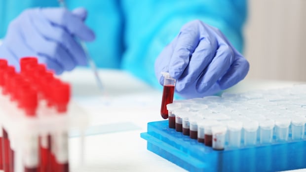 for-over-30-years,-this-small-bc.-city-has-been-testing-children’s-blood-for-lead