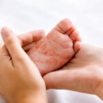 7-new-measles-cases-confirmed-in-manitoba,-provincial-health-officials-warn