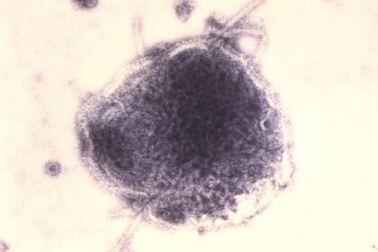 nearly-90%-of-manitoba’s-reported-measles-cases-involved-unvaccinated-patients:-public-health