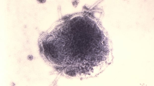 nearly-90%-of-manitoba’s-reported-measles-cases-involved-unvaccinated-patients:-public-health
