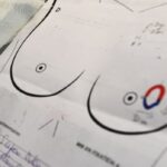 why-do-pregnancy,-breastfeeding-reduce-risk-of-breast-cancer?-latest-science-finds-clues