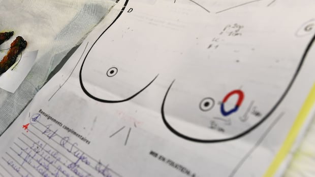 why-do-pregnancy,-breastfeeding-reduce-risk-of-breast-cancer?-latest-science-finds-clues