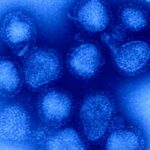 canada-could-face-worst-kind-of-flu-season-as-experts-warn-evolving-strain-may-be-mismatch-for-vaccine