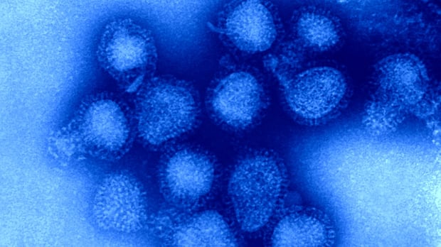 canada-could-face-worst-kind-of-flu-season-as-experts-warn-evolving-strain-may-be-mismatch-for-vaccine