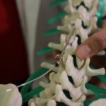 appeal-board-says-manitoba-should-pay-for-out-of-country-spinal-surgery-in-‘deeply-concerning’-case