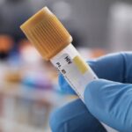 manitoba’s-hiv-infection-rates-were-canada’s-highest-in-2024,-federal-data-suggests