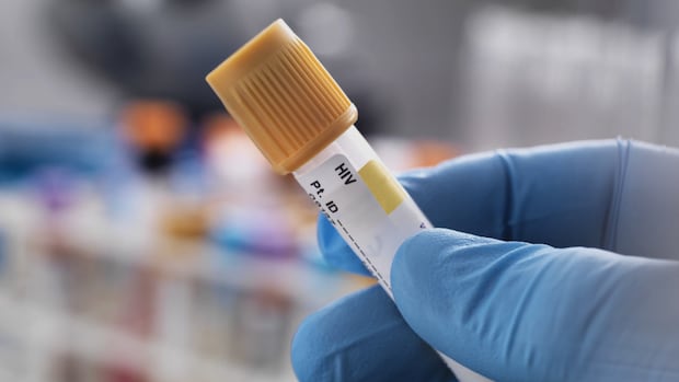 manitoba’s-hiv-infection-rates-were-canada’s-highest-in-2024,-federal-data-suggests