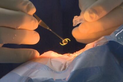 11th-hour-funding-keeps-new-saint-john-area-cataract-clinic-operating